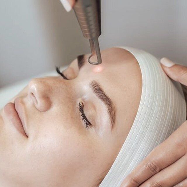 Hydra Facial treatment